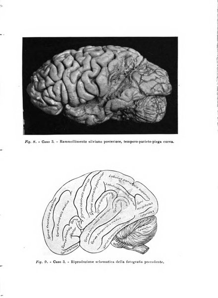 Rivista sperimentale di freniatria e medicina legale delle alienazioni mentali organo della Società freniatrica italiana