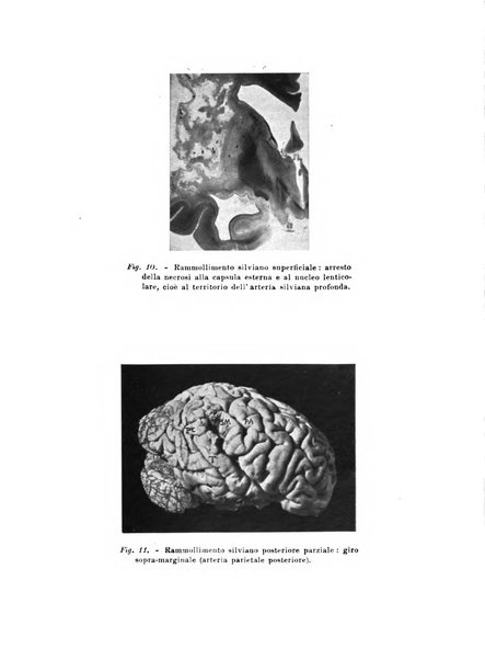 Rivista sperimentale di freniatria e medicina legale delle alienazioni mentali organo della Società freniatrica italiana