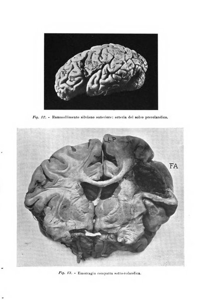 Rivista sperimentale di freniatria e medicina legale delle alienazioni mentali organo della Società freniatrica italiana