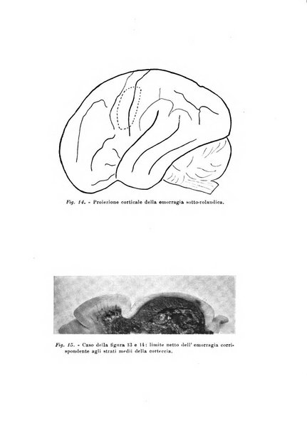 Rivista sperimentale di freniatria e medicina legale delle alienazioni mentali organo della Società freniatrica italiana