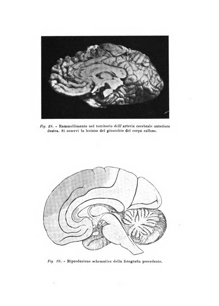 Rivista sperimentale di freniatria e medicina legale delle alienazioni mentali organo della Società freniatrica italiana