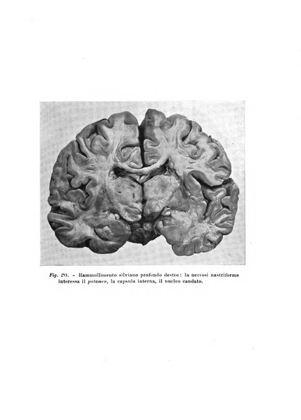 Rivista sperimentale di freniatria e medicina legale delle alienazioni mentali organo della Società freniatrica italiana