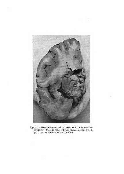 Rivista sperimentale di freniatria e medicina legale delle alienazioni mentali organo della Società freniatrica italiana