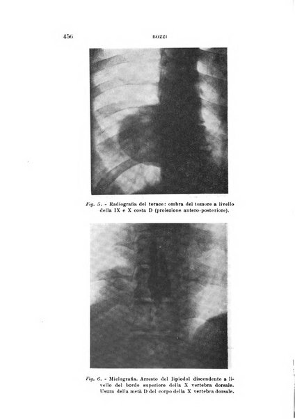 Rivista sperimentale di freniatria e medicina legale delle alienazioni mentali organo della Società freniatrica italiana