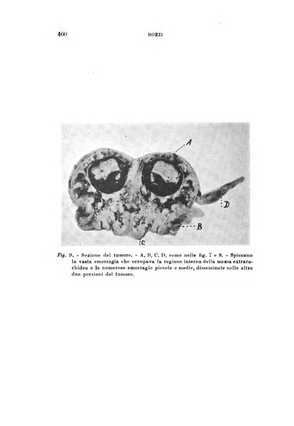 Rivista sperimentale di freniatria e medicina legale delle alienazioni mentali organo della Società freniatrica italiana