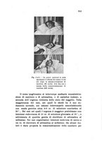 giornale/PUV0028278/1937/unico/00000915