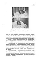 giornale/PUV0028278/1937/unico/00000917