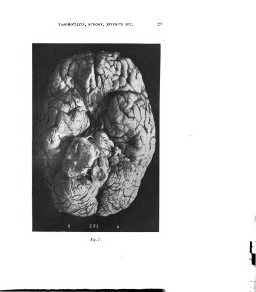 Rivista sperimentale di freniatria e medicina legale delle alienazioni mentali organo della Società freniatrica italiana