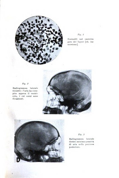 Rivista sperimentale di freniatria e medicina legale delle alienazioni mentali organo della Società freniatrica italiana