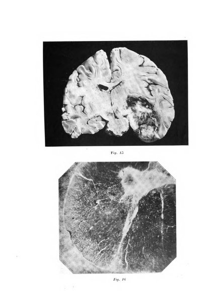 Rivista sperimentale di freniatria e medicina legale delle alienazioni mentali organo della Società freniatrica italiana