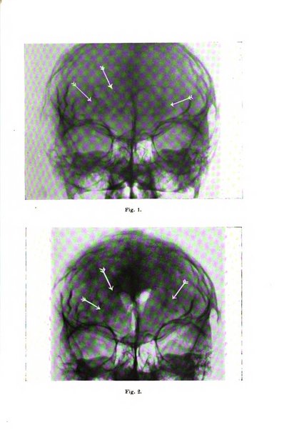 Rivista sperimentale di freniatria e medicina legale delle alienazioni mentali organo della Società freniatrica italiana