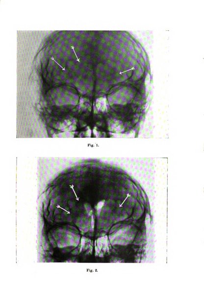 Rivista sperimentale di freniatria e medicina legale delle alienazioni mentali organo della Società freniatrica italiana