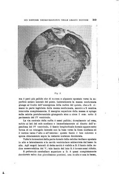 Rivista sperimentale di freniatria e medicina legale delle alienazioni mentali organo della Società freniatrica italiana