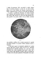 giornale/PUV0041464/1917/unico/00000067