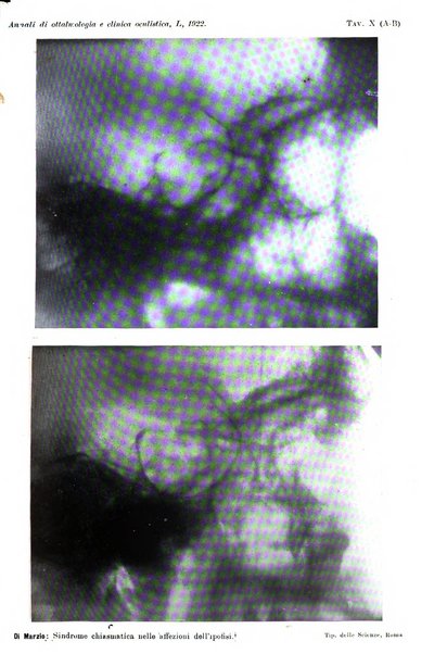 Annali di ottalmologia e clinica oculistica