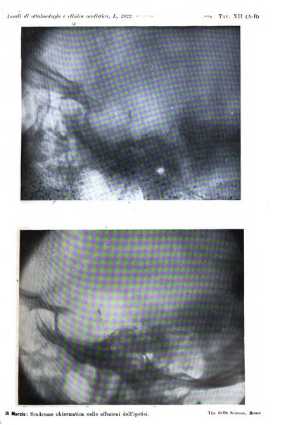 Annali di ottalmologia e clinica oculistica