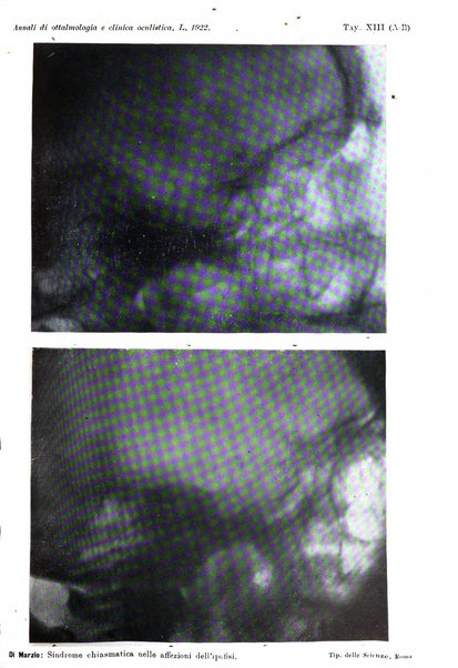 Annali di ottalmologia e clinica oculistica