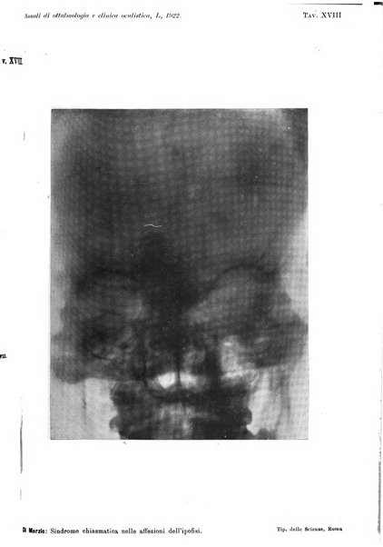 Annali di ottalmologia e clinica oculistica