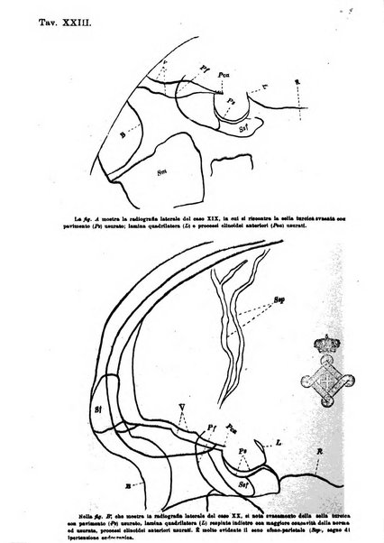 Annali di ottalmologia e clinica oculistica