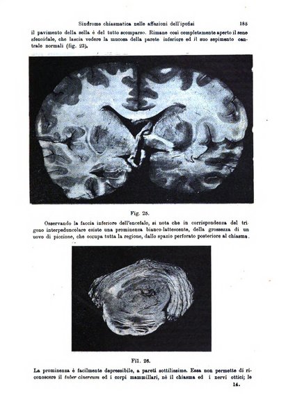 Annali di ottalmologia e clinica oculistica