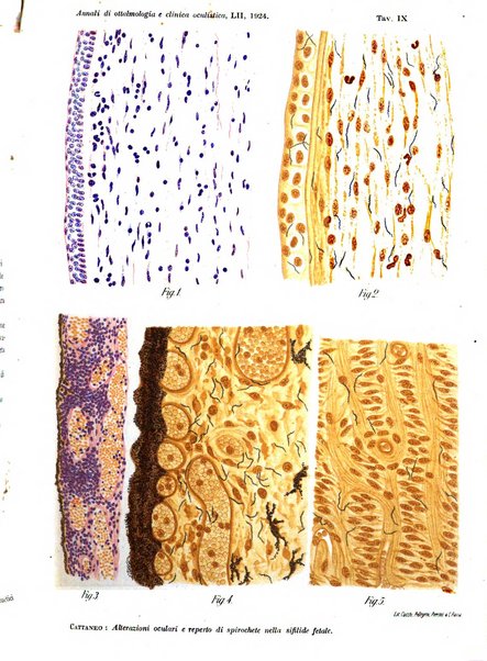 Annali di ottalmologia e clinica oculistica