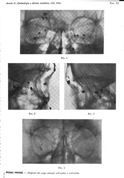 Annali di ottalmologia e clinica oculistica