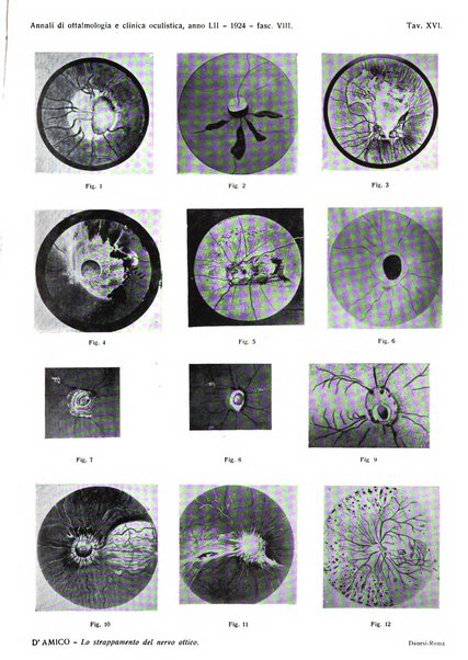 Annali di ottalmologia e clinica oculistica