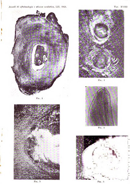 Annali di ottalmologia e clinica oculistica