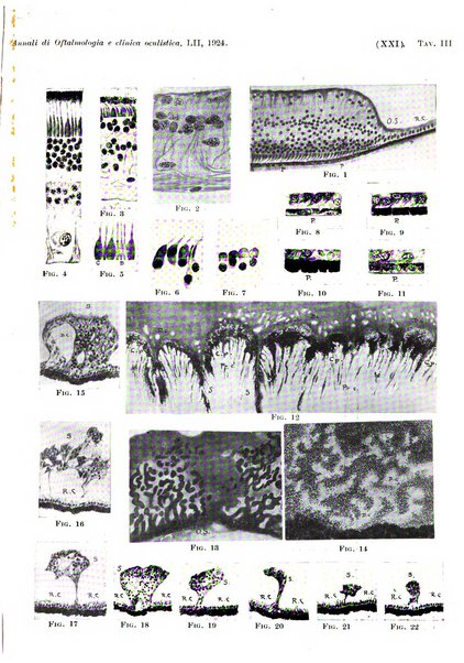 Annali di ottalmologia e clinica oculistica