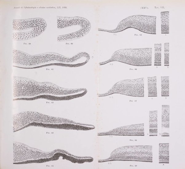 Annali di ottalmologia e clinica oculistica