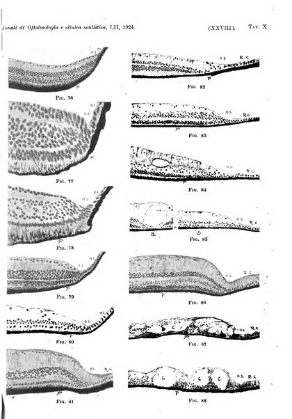 Annali di ottalmologia e clinica oculistica