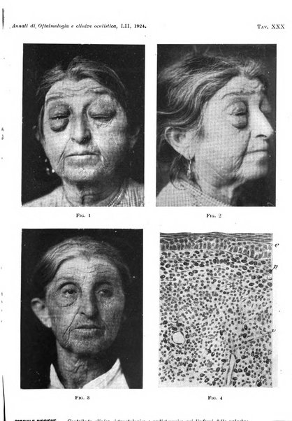 Annali di ottalmologia e clinica oculistica