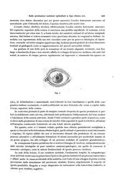 Annali di ottalmologia e clinica oculistica