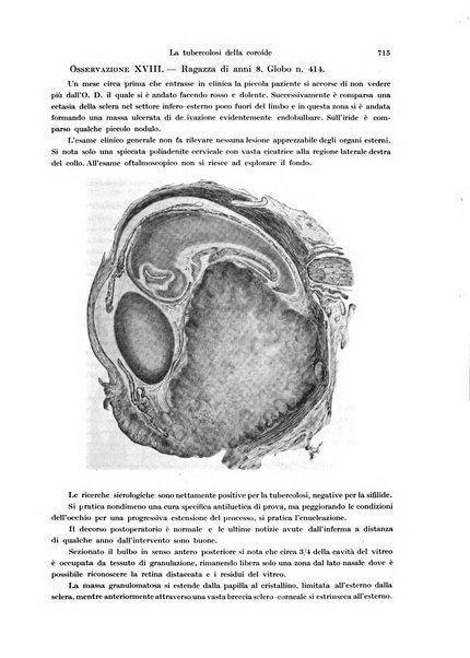 Annali di ottalmologia e clinica oculistica