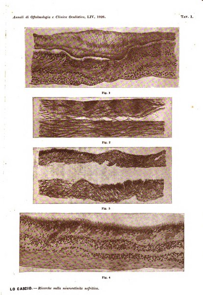 Annali di ottalmologia e clinica oculistica