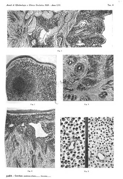 Annali di ottalmologia e clinica oculistica