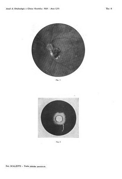 Annali di ottalmologia e clinica oculistica