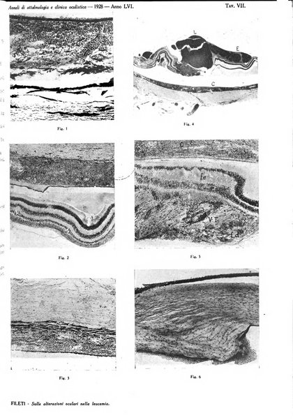 Annali di ottalmologia e clinica oculistica