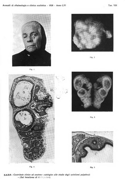 Annali di ottalmologia e clinica oculistica