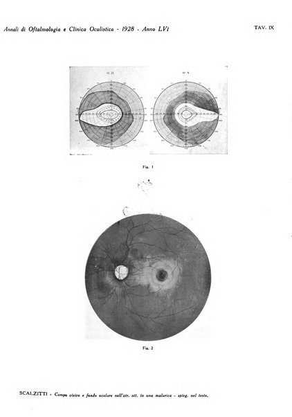 Annali di ottalmologia e clinica oculistica