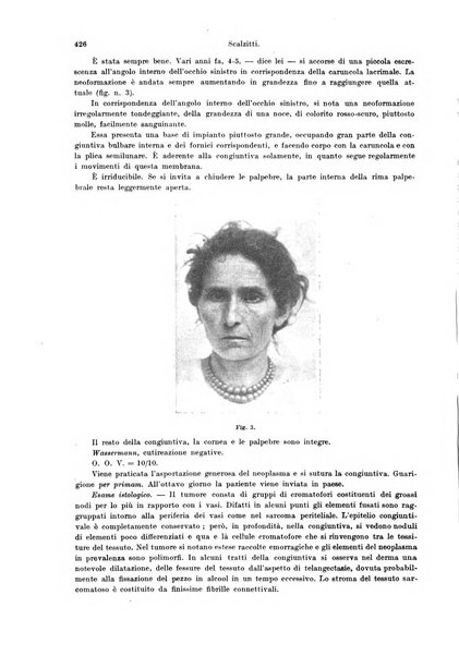 Annali di ottalmologia e clinica oculistica