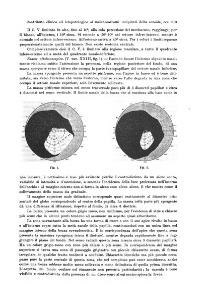 Annali di ottalmologia e clinica oculistica