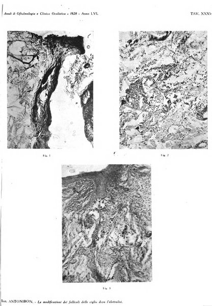 Annali di ottalmologia e clinica oculistica