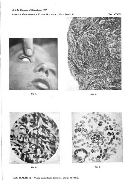 Annali di ottalmologia e clinica oculistica