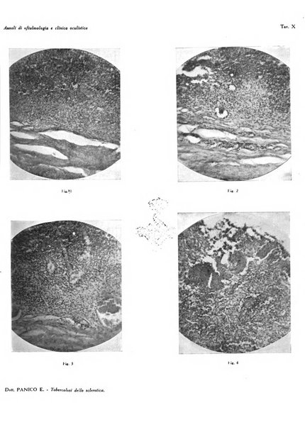 Annali di ottalmologia e clinica oculistica