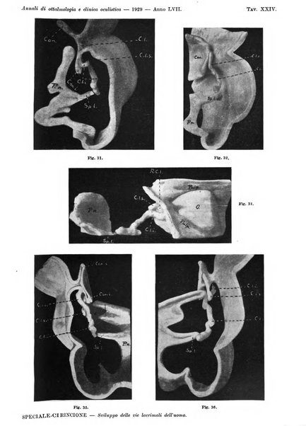 Annali di ottalmologia e clinica oculistica