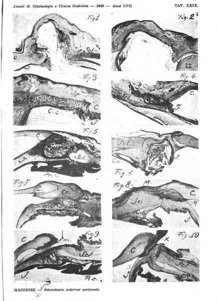 Annali di ottalmologia e clinica oculistica