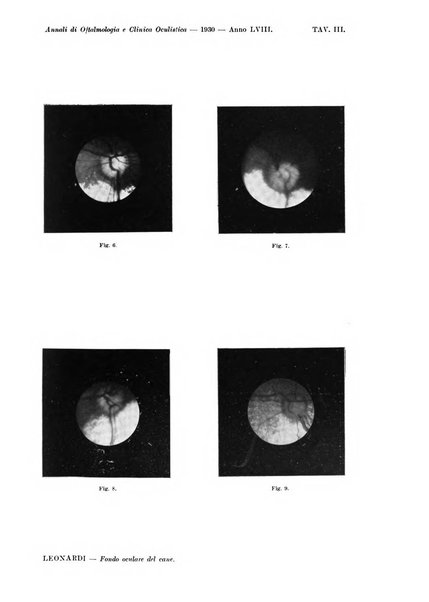 Annali di ottalmologia e clinica oculistica