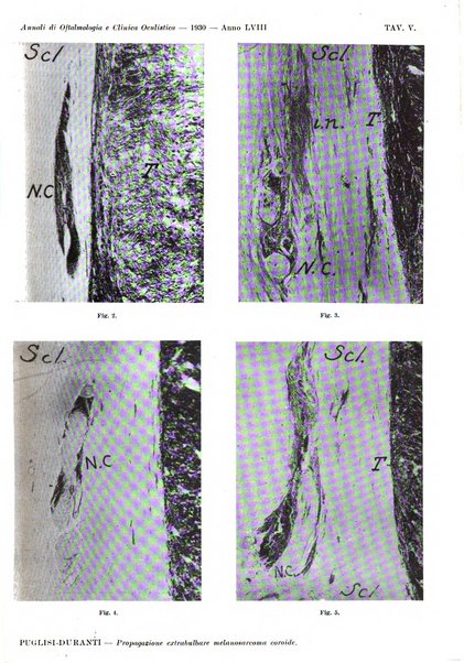 Annali di ottalmologia e clinica oculistica