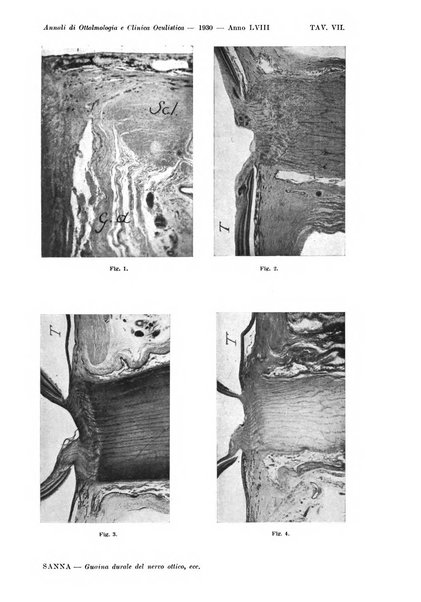 Annali di ottalmologia e clinica oculistica